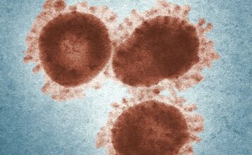 Reportan la primera muerte por sarampión en Guerrero