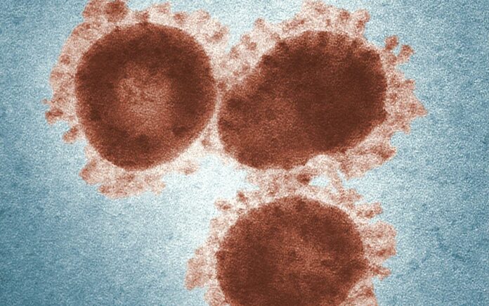 sarampion-muere-mexicano-infectado